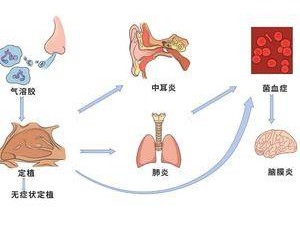 這個菌，每年有近20萬兒童和老人因它而病倒｜熱點關注