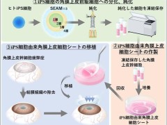 大阪大学新突破：iPS再生组织助力4名LSCD患者角膜修复，重获光明！