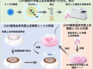 大阪大学新突破：iPS再生组织助力4名LSCD患者角膜修复，重获光明！