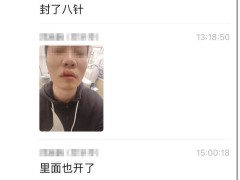 小鹏充电事故：车主被线缆扭转力砸伤，小鹏回应将加强安全指引